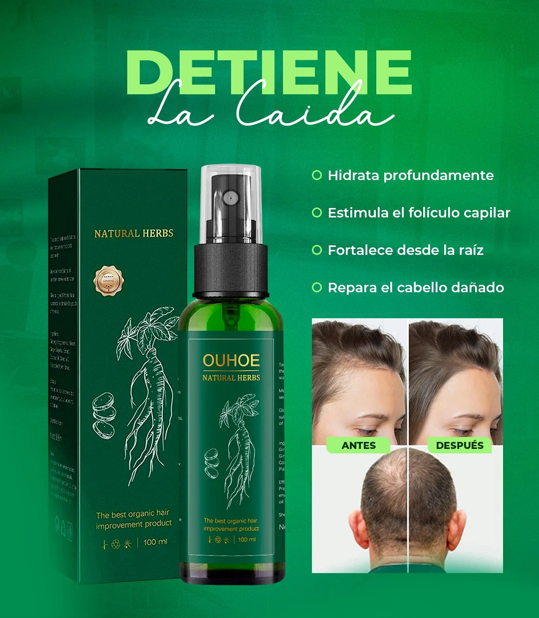 Ouhoe 100ml Crecimiento De Cabello Y Control De Caida.